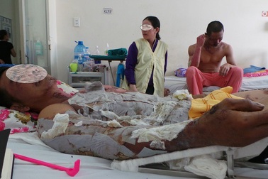 Dùng tế bào gốc nhung hươu làm băng trị liền vết thương