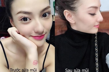 Hồng Quế công khai chuyện làm mũi, cho rằng “mũi gồ vất vả tình duyên”