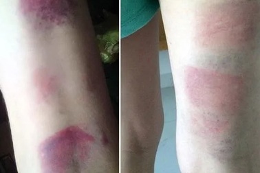 Bộ GD&ĐT chỉ đạo “nóng” vụ giáo viên bị tố đánh 22 học sinh ở Vũng Tàu