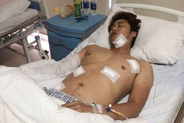 Bảo vệ nhân viên, một giám đốc nghi bị côn đồ chém trọng thương