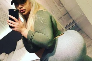 4 năm 3 lần phẫu thuật, cô gái nuôi ước vọng có vòng 3 to nhất thế giới