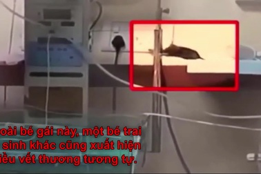 Trẻ sơ sinh thiệt mạng vì bị chuột cắn khi đang ở trong bệnh viện