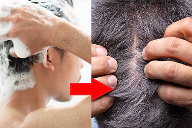 Cách chọn dầu gội trị ngứa da đầu phù hợp