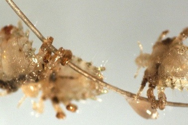 Bệnh lây khi làm “chuyện ấy” “nhảy” lên mắt gây họa