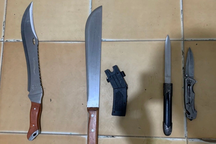 Tạm giữ hình sự băng nhóm chém người đứt lìa bàn tay