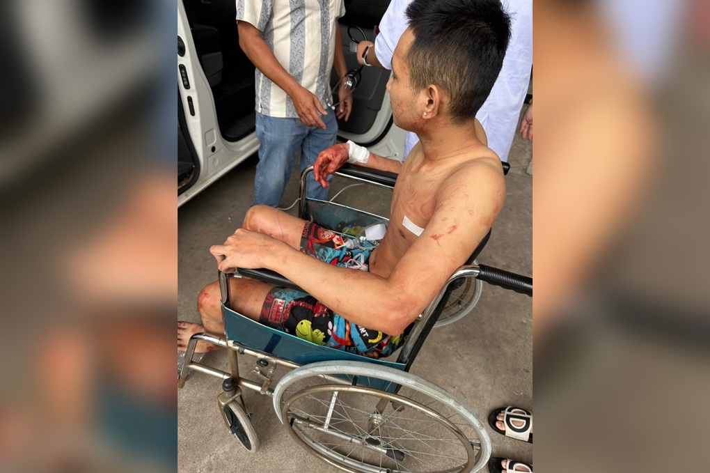 Hai thanh niên bước ra khỏi quán bida bị đâm trọng thương - 1 Hai thanh niên bước ra khỏi quán bida bị đâm trọng thương - 1