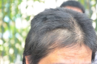 Bắt người tình của bố về nhà cắt tóc, đánh đập dã man