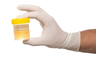 Xét nghiệm bệnh thận giúp cảnh báo nguy cơ sa sút trí tuệ