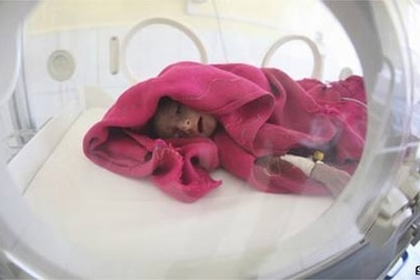 Sinh non liên quan với sức khỏe tâm thần kém