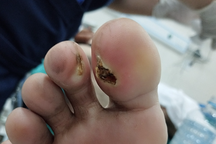 Dùng gậy nhôm gạt dây điện, nam thanh niên bị điện giật