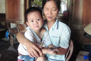 Bà mù nuôi cháu dại