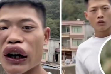 Cái kết đắng của chàng trai ăn ong bắp cày, rết sống để câu view trên mạng