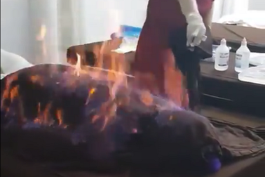 Sự thật về phương pháp hỏa liệu trị bệnh quảng cáo "tràn" trên mạng