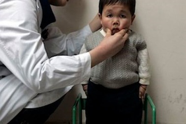 Ai sẽ là người thấp nhất thế giới?