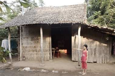 Bé 7 tuổi bị bỏng nặng vì bắt chước ngậm xăng phun lửa