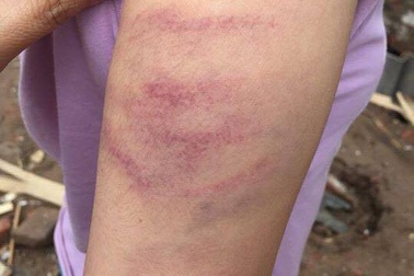 6 vụ giáo viên “xuống tay” với học sinh gây bất bình dư luận năm 2017