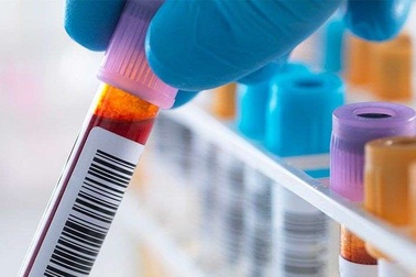 5 câu nên hỏi về kết quả xét nghiệm máu