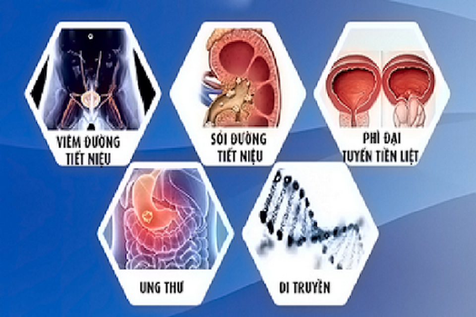 Điểm mặt thủ phạm gây tiểu máu - 1 Điểm mặt thủ phạm gây tiểu máu - 1