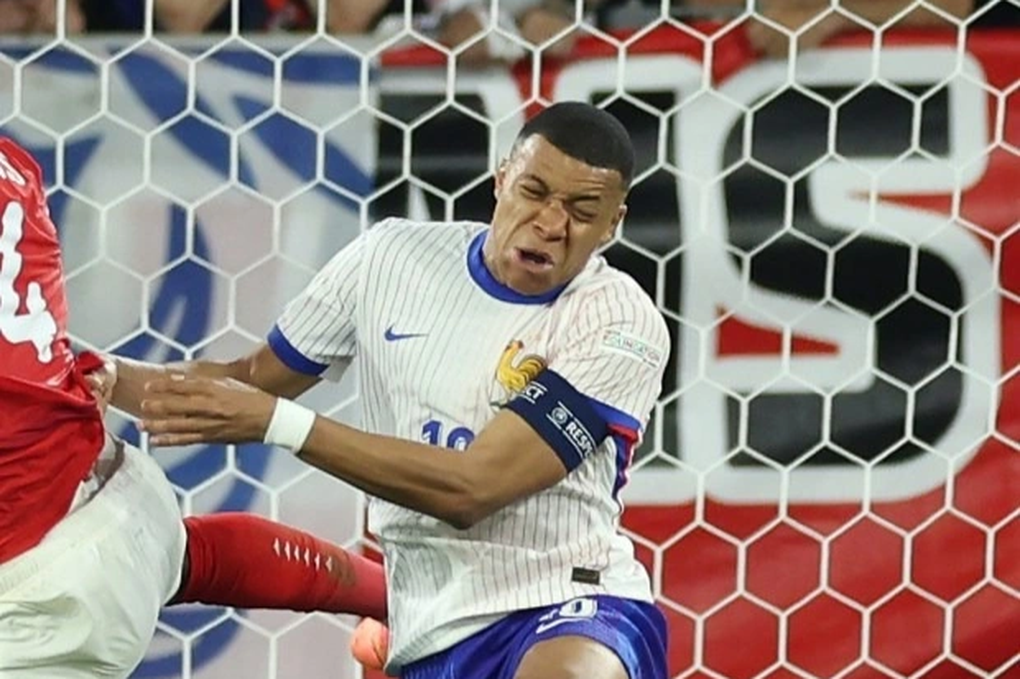 Mbappe trở lại tập luyện cùng tuyển Pháp sau khi bị gãy mũi - 1 Mbappe trở lại tập luyện cùng tuyển Pháp sau khi bị gãy mũi - 1