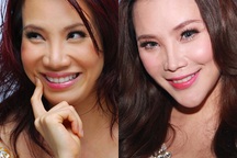 Hồ Quỳnh Hương và nghi án cằm lệch