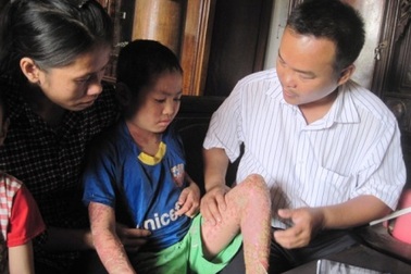 Cháu Kỳ “vảy nến” sẽ được giúp đỡ chữa bệnh miễn phí