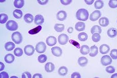 Chế tạo thành công 4 loại test phát hiện ký sinh trùng sốt rét