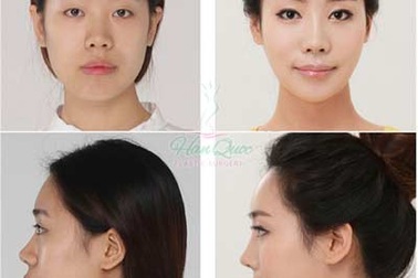 Thẩm mỹ JW - Thương hiệu thẩm mỹ Hàn Quốc chính thức tại Việt Nam