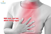 Những đối tượng F0 khỏi bệnh nên đi khám hậu Covid-19