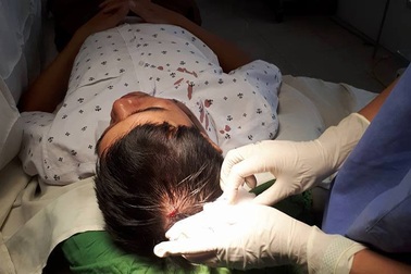 Bác sĩ phải khâu 5 mũi vì bị người lạ ném máy đo huyết áp vào đầu