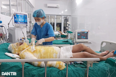 Vợ nghèo bán lúa non khẩn cầu bạn đọc cứu chồng bị bỏng nặng