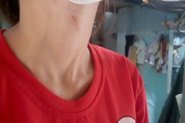 Cô gái ở TPHCM bị kẻ cướp táo tợn kề dao vào cổ lấy bông tai
