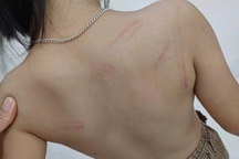 Vụ nhiều trẻ mầm non bị đánh: Phụ huynh xin không kỷ luật cô giáo