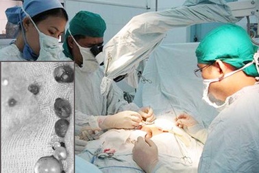 Trào lưu bơm to "cậu nhỏ"