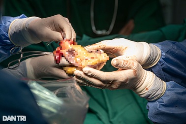 50 năm sau thống nhất, Việt Nam chói sáng trên bản đồ ghép tạng thế giới