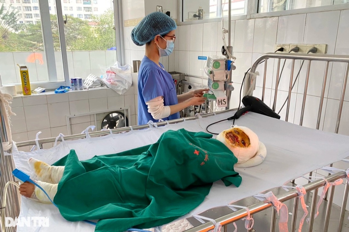 Bé 3 tuổi bị nhấn chìm trong ngọn lửa hung dữ cầu xin được cứu sống - 6 Bé 3 tuổi bị nhấn chìm trong ngọn lửa hung dữ cầu xin được cứu sống - 6