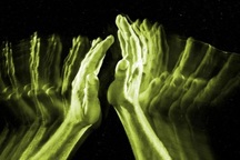 Hội chứng "bàn tay người ngoài hành tinh": Kẻ nổi loạn trong chính cơ thể