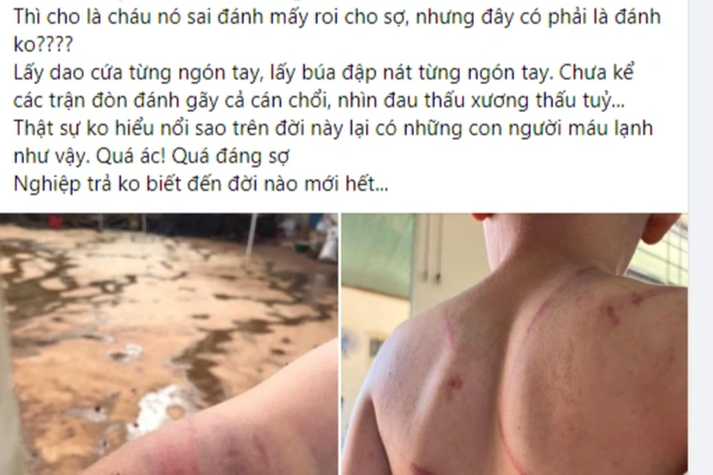 Bé trai 9 tuổi bị bố và bà nội đánh đập kinh hoàng - 4 Bé trai 9 tuổi bị bố và bà nội đánh đập kinh hoàng - 4