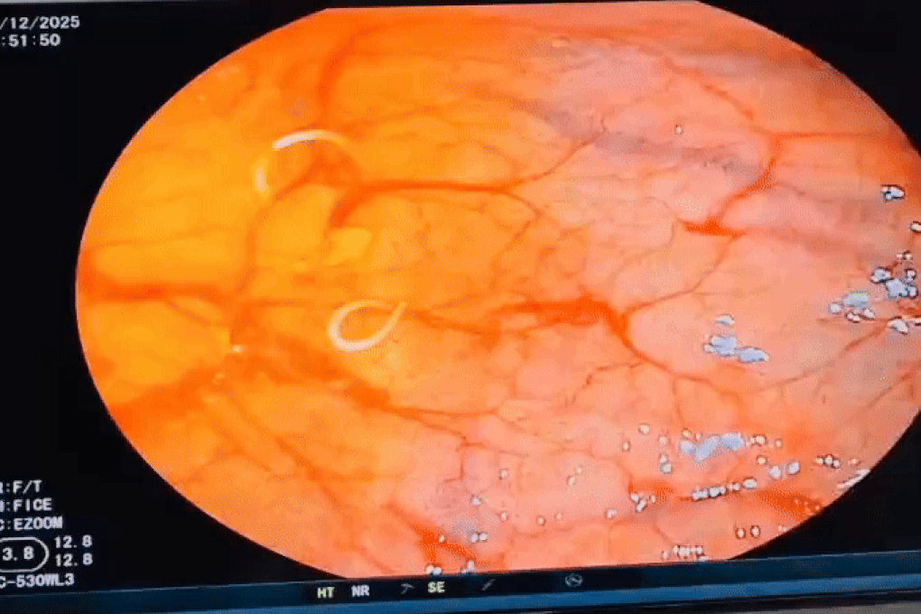 ایک ڈش بہت سے لوگوں کو پسند ہے جو عورت کے پیٹ میں کیڑے بھیجتی ہے - 1 Món nhiều người mê đưa ổ giun vào bụng người phụ nữ - 1