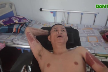 Thảm cảnh người đàn ông cụt hai chân