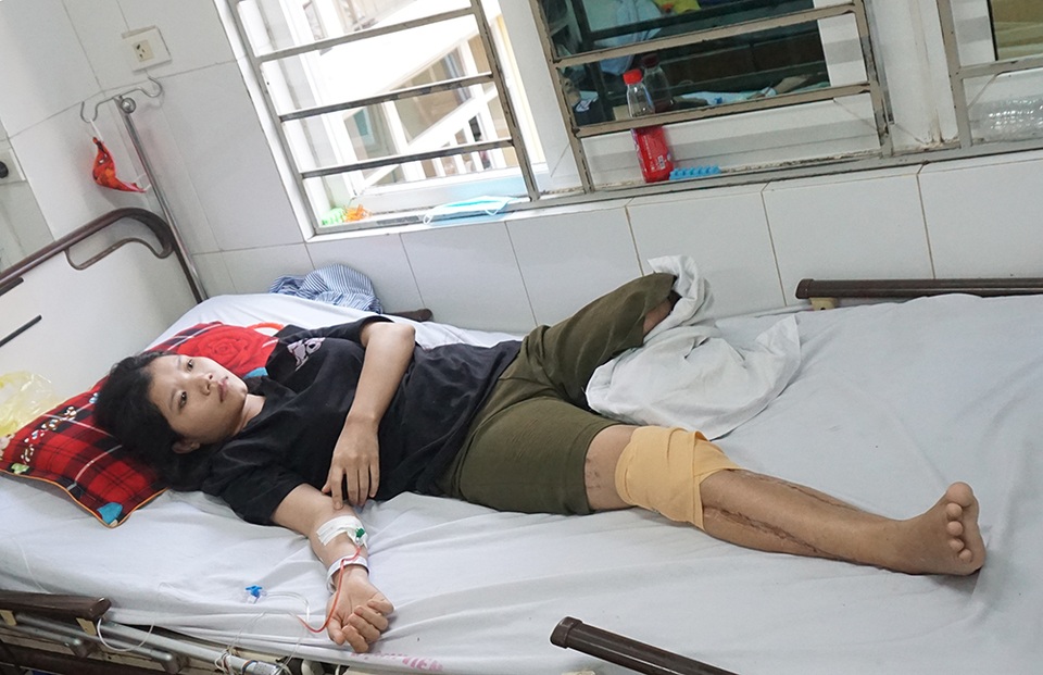 Người phụ nữ cùng lúc mất cả chồng lẫn con mơ một chiếc chân giả - 1 Người phụ nữ cùng lúc mất cả chồng lẫn con mơ một chiếc chân giả - 1