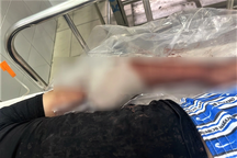 Chém người gần lìa cánh tay vì 20.000 đồng tiền cá viên chiên