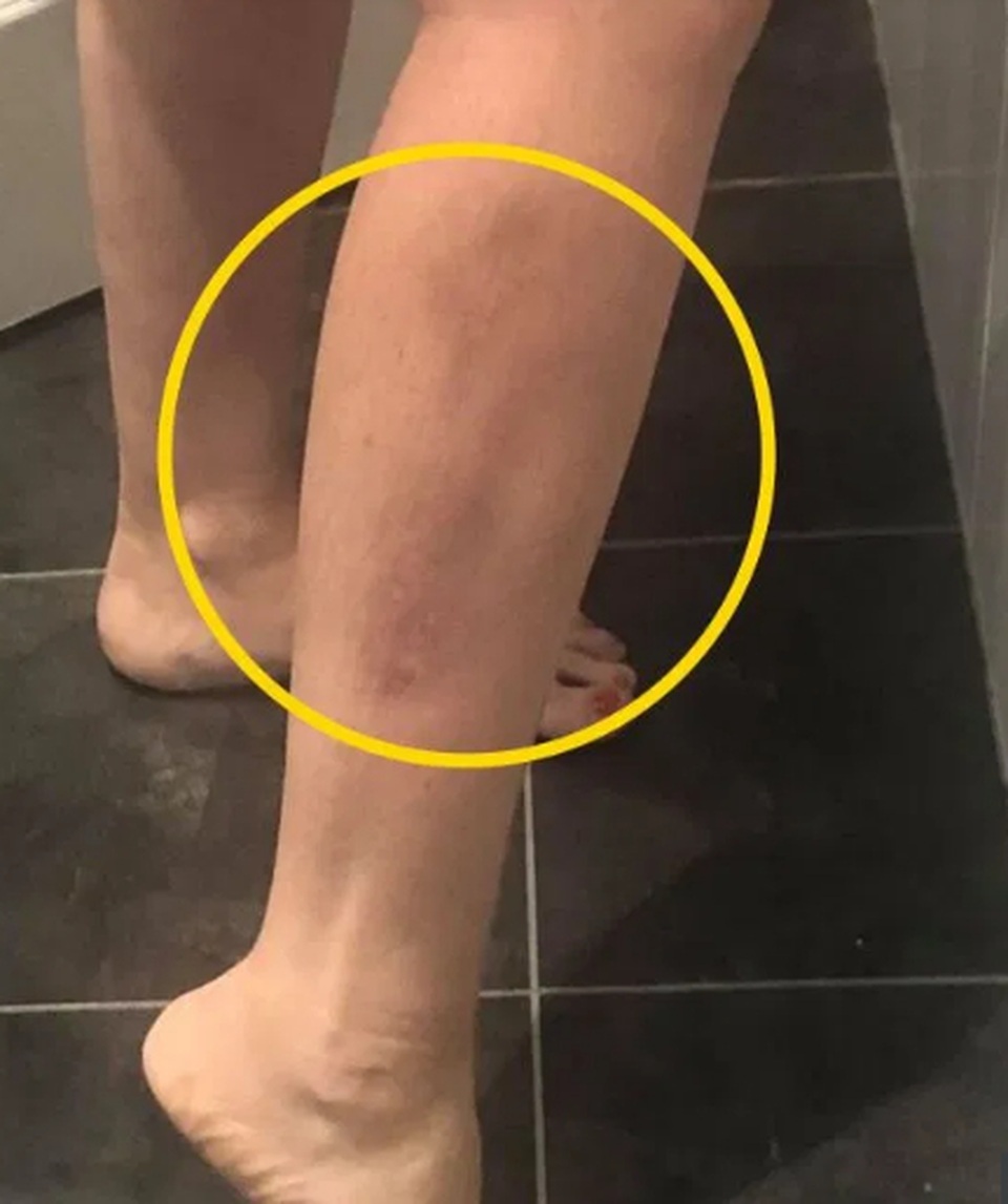 Người phụ nữ phát hiện mình bị ung thư nhờ... xem phim - 3 Người phụ nữ phát hiện mình bị ung thư nhờ... xem phim - 3