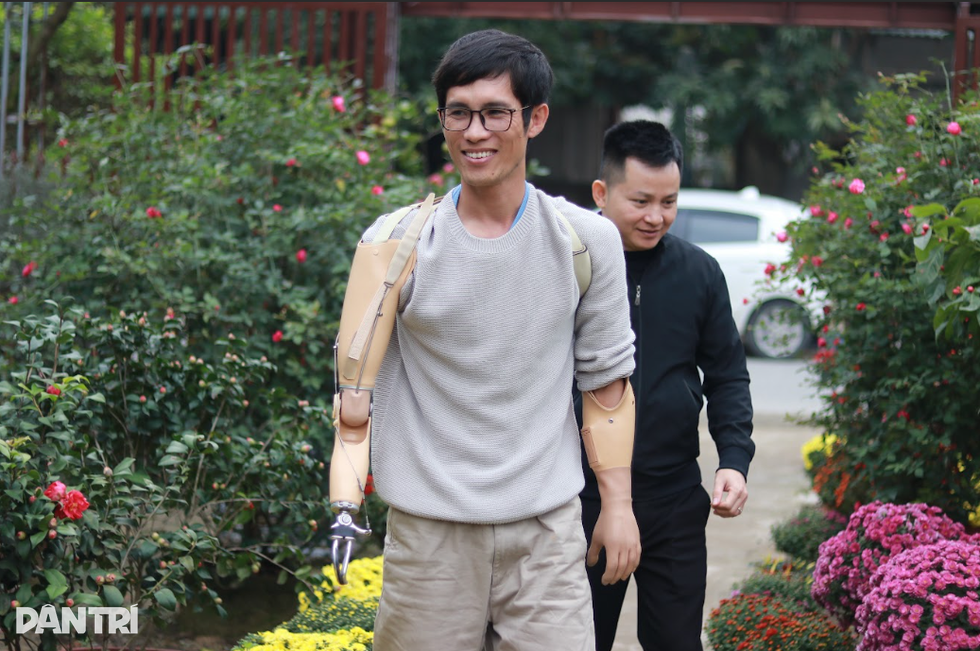 Bước ngoặt cuộc đời của chàng kỹ sư mất đôi tay nơi xứ người - 1