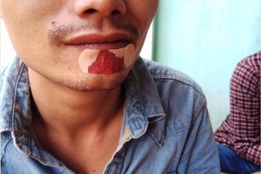 Đi ăn liên hoan đậu đại học, bị đánh tới tấp