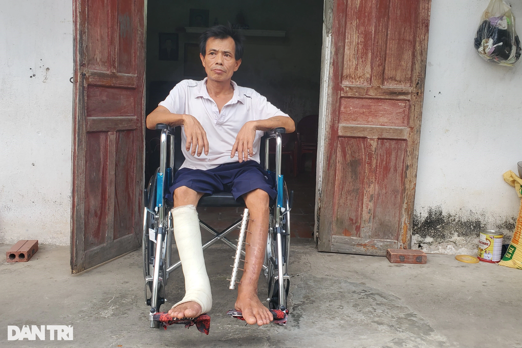 Cú trượt chân vào máy xúc của người đàn ông đẩy gia đình vào cơn bĩ cực - 1 Cú trượt chân vào máy xúc của người đàn ông đẩy gia đình vào cơn bĩ cực - 1