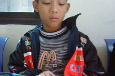 Tỷ lệ thương tật của cháu bé bị anh họ thiêu đốt tăng gần... gấp đôi