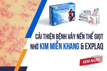 Cải thiện bệnh vảy nến thể giọt nhờ Kim Miễn Khang & Explaq