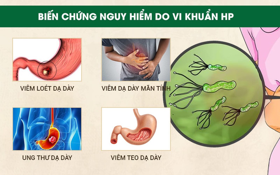 5 điều cần làm để ngừa ung thư dạ dày - 2 5 điều cần làm để ngừa ung thư dạ dày - 2