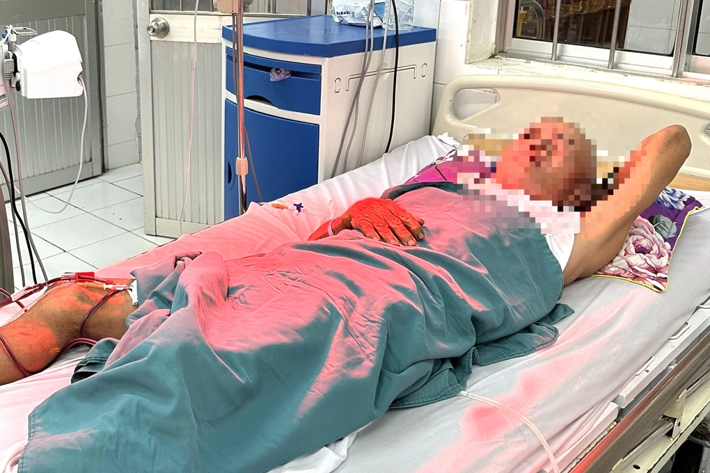 Nghi ngộ độc rượu: Một người chết, 7 người vào viện - 1 Nghi ngộ độc rượu: Một người chết, 7 người vào viện - 1
