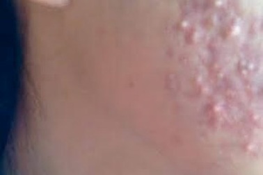 Trả giá vì muốn làm đẹp “nhanh gọn lẹ”